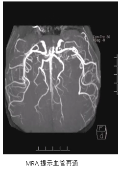 病历夹什么径技·第151期｜串联营病历夹：京广连营_https://www.jmylbn.com_新闻资讯_第31张