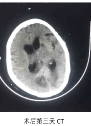 病历夹什么径技·第151期｜串联营病历夹：京广连营_https://www.jmylbn.com_新闻资讯_第80张
