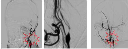 病历夹什么径技·第151期｜串联营病历夹：京广连营_https://www.jmylbn.com_新闻资讯_第8张