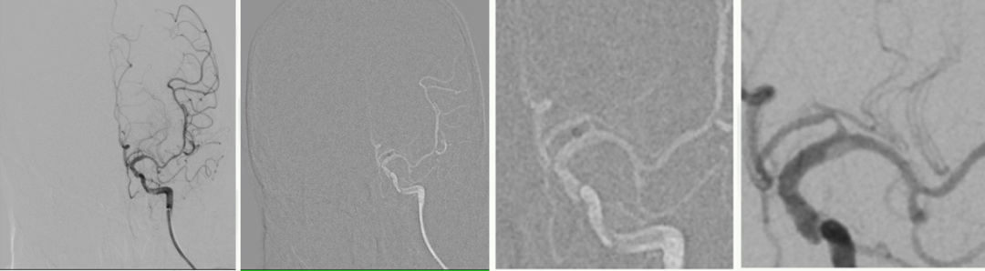 病历夹什么径技·第151期｜串联营病历夹：京广连营_https://www.jmylbn.com_新闻资讯_第12张