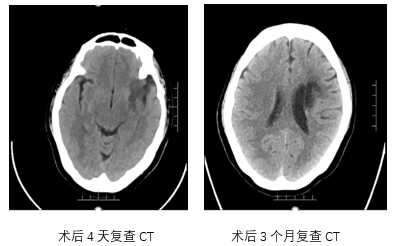 病历夹什么径技·第151期｜串联营病历夹：京广连营_https://www.jmylbn.com_新闻资讯_第33张