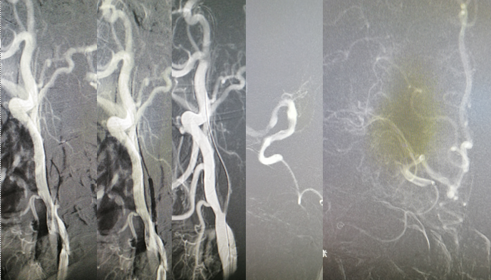病历夹什么径技·第151期｜串联营病历夹：京广连营_https://www.jmylbn.com_新闻资讯_第62张