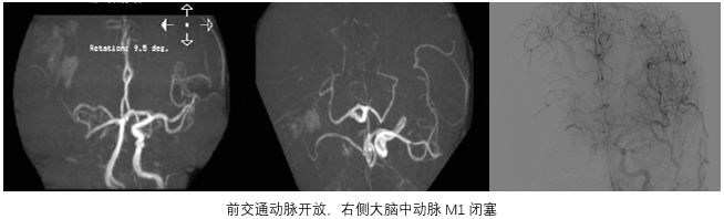 病历夹什么径技·第151期｜串联营病历夹：京广连营_https://www.jmylbn.com_新闻资讯_第51张