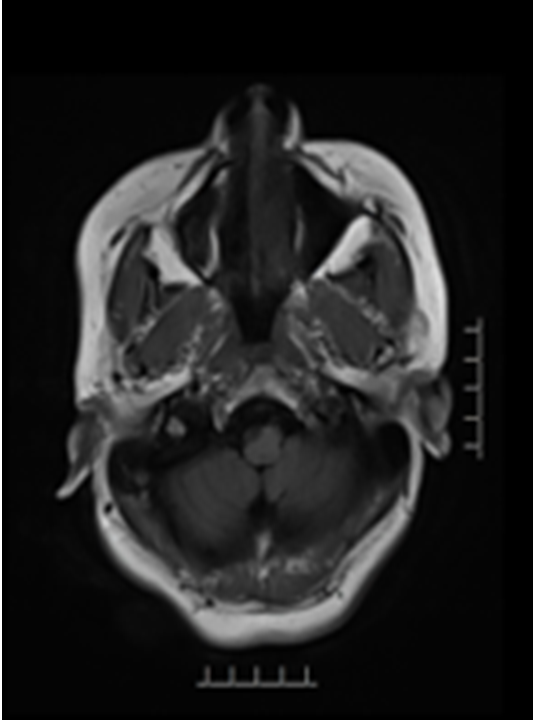 病历夹什么径技·第151期｜串联营病历夹：京广连营_https://www.jmylbn.com_新闻资讯_第23张