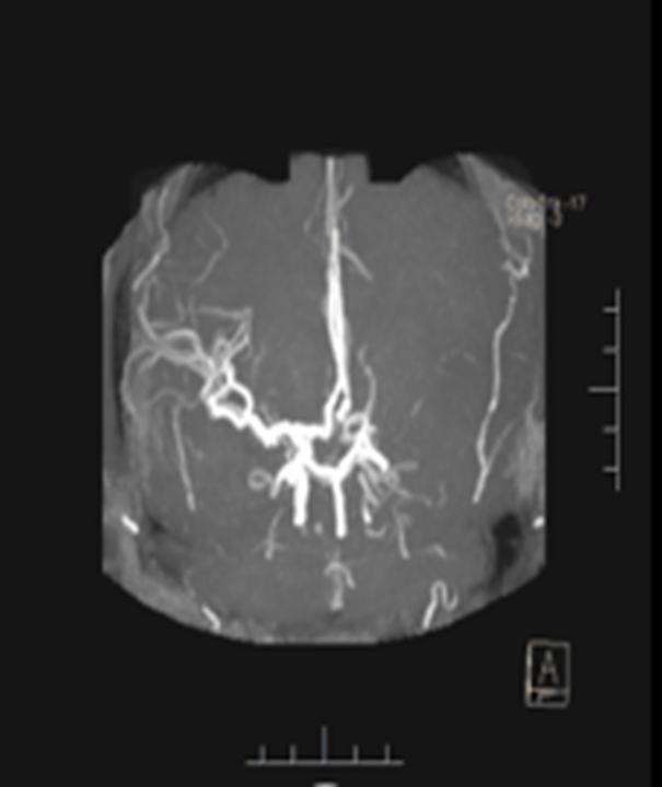 病历夹什么径技·第151期｜串联营病历夹：京广连营_https://www.jmylbn.com_新闻资讯_第24张