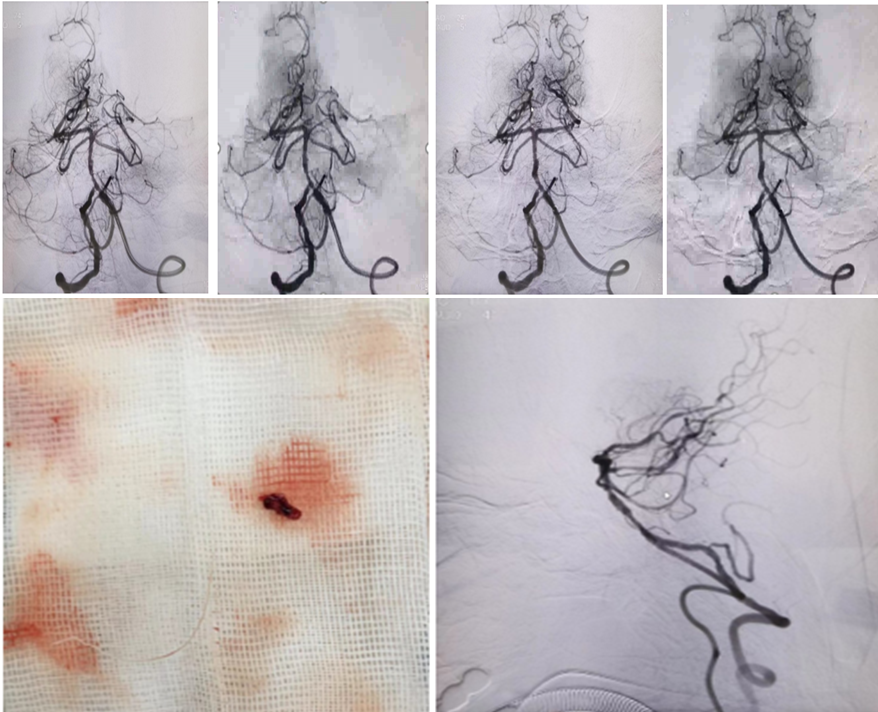 病历夹什么径技·第151期｜串联营病历夹：京广连营_https://www.jmylbn.com_新闻资讯_第77张