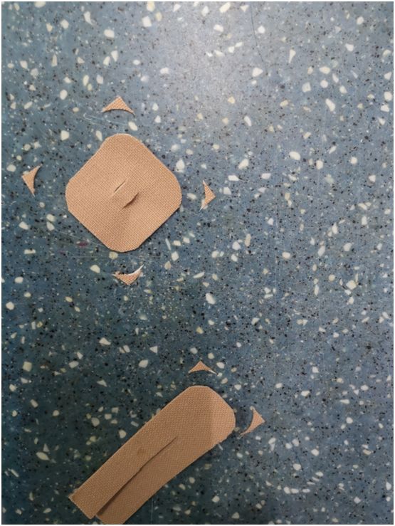 留置胃管鼻贴怎么贴鼻胃管固定不牢麻烦多？教你一种改良固定法~_https://www.jmylbn.com_新闻资讯_第2张