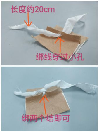 尿管怎么固定别人家的尿管固定法，你也值得拥有~_https://www.jmylbn.com_新闻资讯_第7张