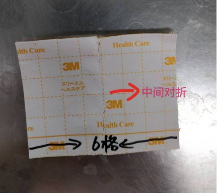 尿管怎么固定别人家的尿管固定法，你也值得拥有~_https://www.jmylbn.com_新闻资讯_第4张