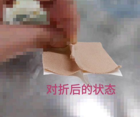 尿管怎么固定别人家的尿管固定法，你也值得拥有~_https://www.jmylbn.com_新闻资讯_第5张