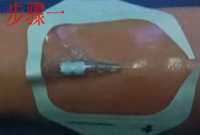 留置针怎么贴膜静脉留置针贴膜应该怎么贴？你的做法很可能是错的_https://www.jmylbn.com_新闻资讯_第2张