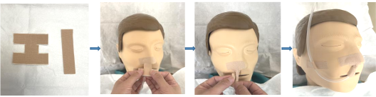 怎么固定引流管外科最常见的3种引流管固定方法（图文并茂）_https://www.jmylbn.com_新闻资讯_第4张