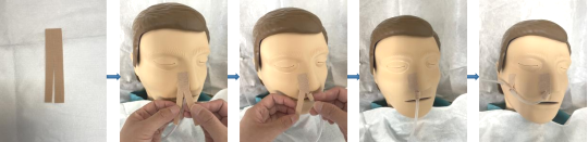 怎么固定引流管外科最常见的3种引流管固定方法（图文并茂）_https://www.jmylbn.com_新闻资讯_第6张