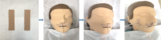 怎么固定引流管外科最常见的3种引流管固定方法（图文并茂）_https://www.jmylbn.com_新闻资讯_第8张