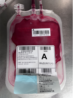 为什么要加热输血术中输血，需要注意什么？_https://www.jmylbn.com_新闻资讯_第4张