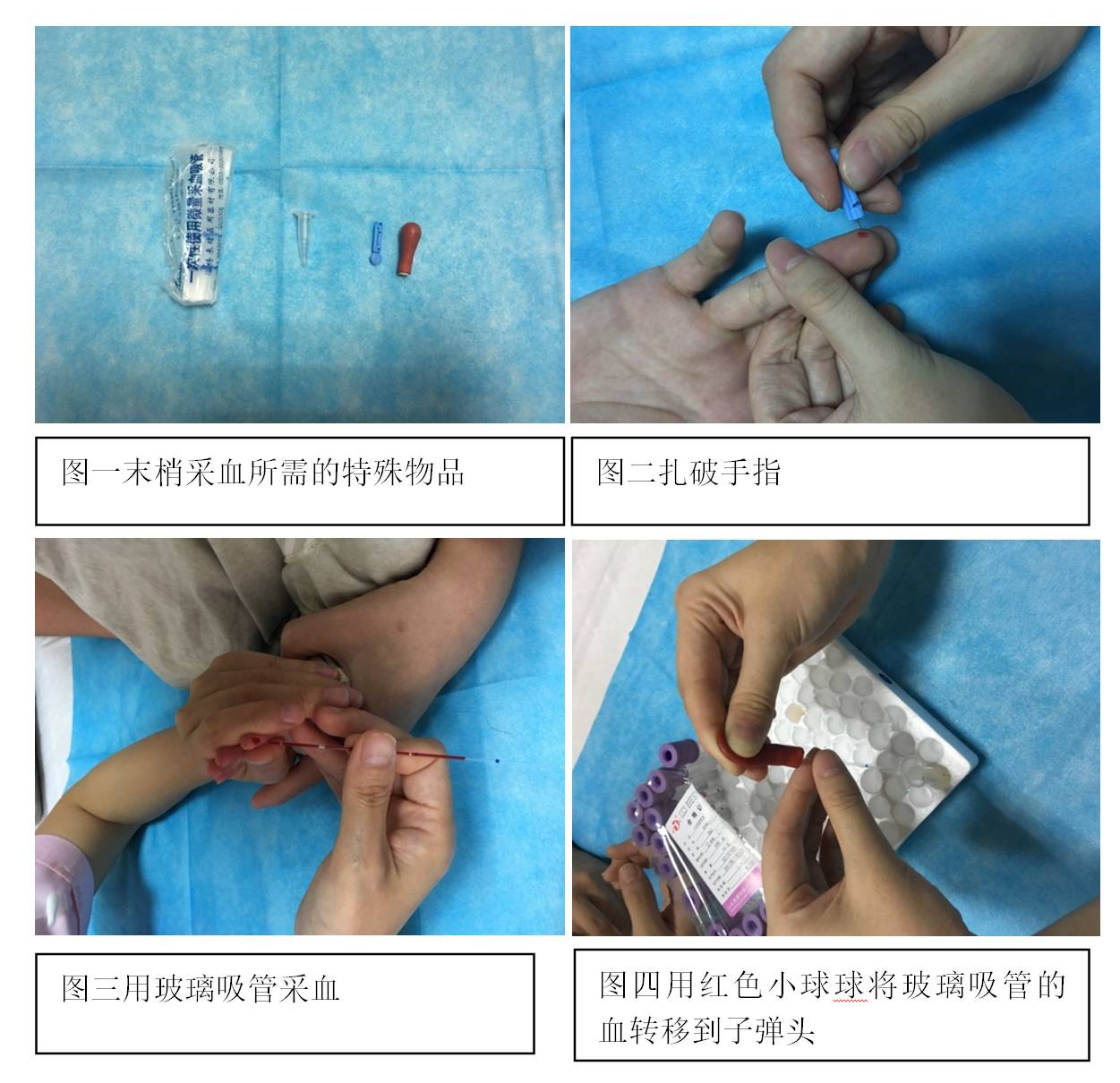 换个思路采血我们这样做