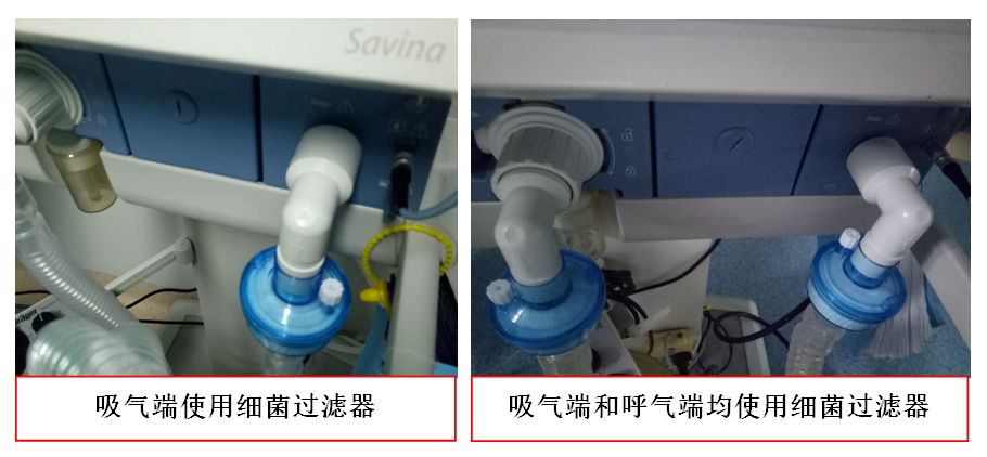人工鼻怎么使用护士，你留意过呼吸机细菌过滤器吗？_https://www.jmylbn.com_新闻资讯_第6张