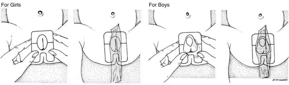 化验大便怎么采集宝宝腹泻，家长如何居家采集大便标本？这几点一定要注意！_https://www.jmylbn.com_新闻资讯_第9张