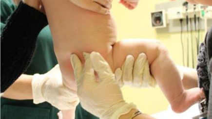 化验大便怎么采集宝宝腹泻，家长如何居家采集大便标本？这几点一定要注意！_https://www.jmylbn.com_新闻资讯_第6张