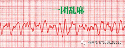 cpr按压板怎么放置关于心肺复苏需要掌握的知识点汇总_https://www.jmylbn.com_新闻资讯_第5张