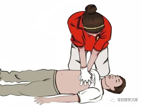 aed电极贴怎么贴AED除颤仪怎么用？看这篇就够了_https://www.jmylbn.com_新闻资讯_第10张