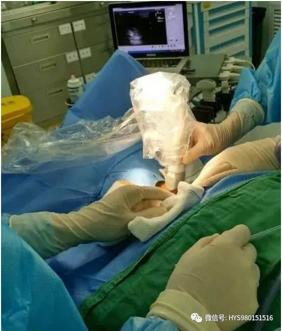 为什么负压引流伤口迁延不愈，这样处理有奇效_https://www.jmylbn.com_新闻资讯_第9张