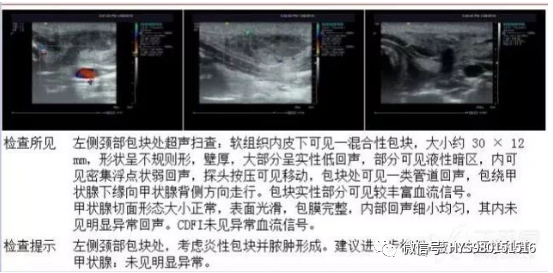 为什么负压引流伤口迁延不愈，这样处理有奇效_https://www.jmylbn.com_新闻资讯_第8张