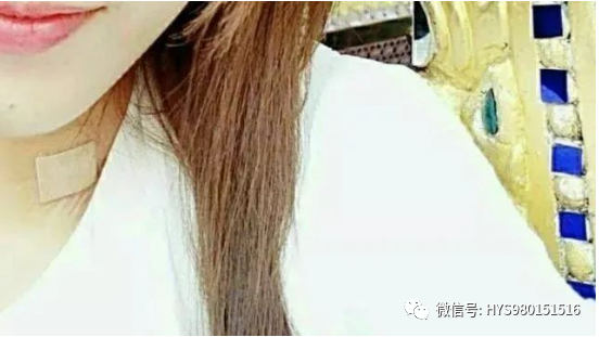 为什么负压引流伤口迁延不愈，这样处理有奇效_https://www.jmylbn.com_新闻资讯_第13张