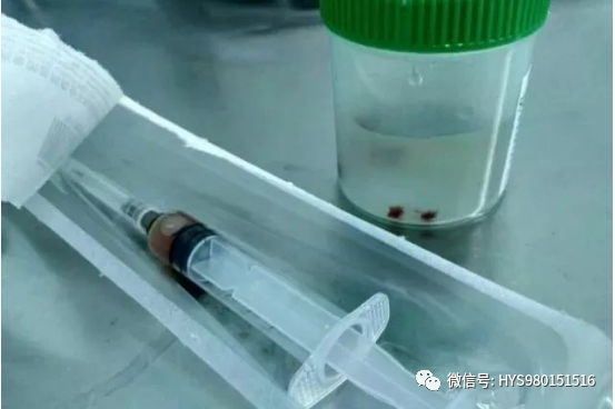 为什么负压引流伤口迁延不愈，这样处理有奇效_https://www.jmylbn.com_新闻资讯_第10张