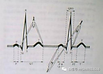 心电图纸的描述有哪些一文全解析 心电图到底该怎么看？_https://www.jmylbn.com_新闻资讯_第32张