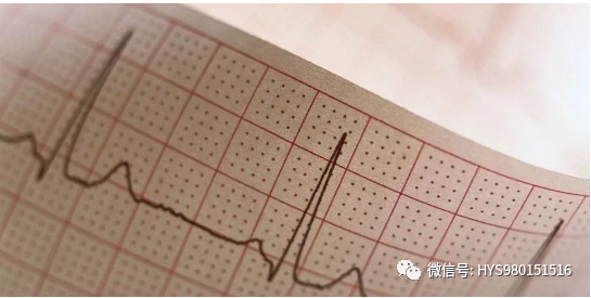 心电图纸的描述有哪些一文全解析 心电图到底该怎么看？_https://www.jmylbn.com_新闻资讯_第4张