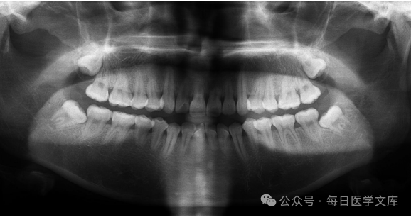 x光机为什么X光机的拍摄技术与心得，牙医和护士都要懂！_https://www.jmylbn.com_新闻资讯_第4张