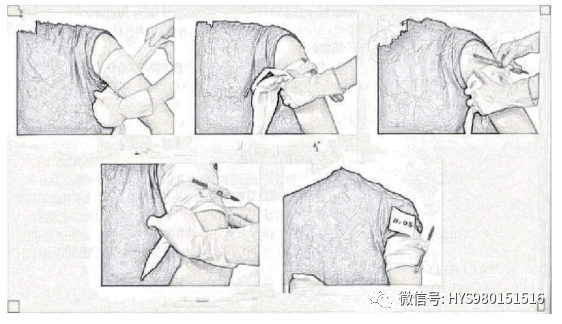 止血带有哪些骨科常用止血带大全，赶紧收藏！_https://www.jmylbn.com_新闻资讯_第5张