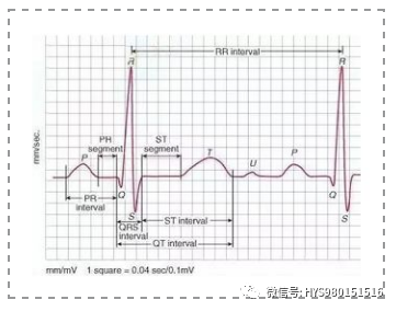 凯进心电图怎么打记忆医师资格考试 心电图记忆口诀来了，考生速记_https://www.jmylbn.com_新闻资讯_第6张