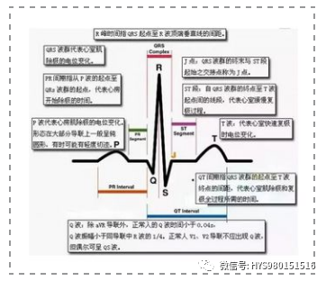 凯进心电图怎么打记忆医师资格考试 心电图记忆口诀来了，考生速记_https://www.jmylbn.com_新闻资讯_第8张