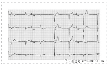 凯进心电图怎么打记忆医师资格考试 心电图记忆口诀来了，考生速记_https://www.jmylbn.com_新闻资讯_第7张