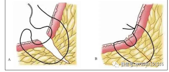 3分钟get真正的外科缝合秘籍