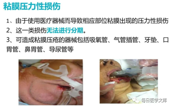 性敷料是什么压力性损伤的临床分期及措施_https://www.jmylbn.com_新闻资讯_第14张