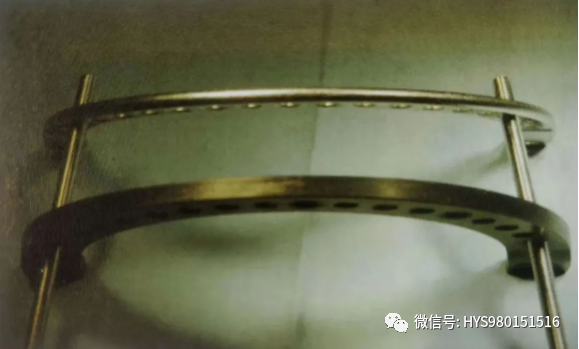 什么是外固定架胫骨近端骨折：环形外固定架_https://www.jmylbn.com_新闻资讯_第18张