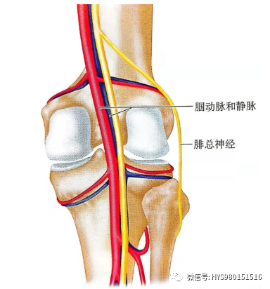 什么是外固定架胫骨近端骨折：环形外固定架_https://www.jmylbn.com_新闻资讯_第10张