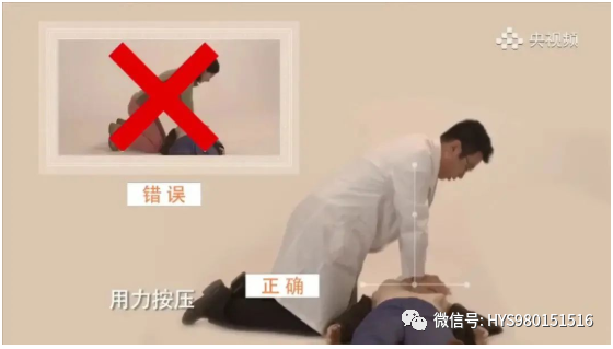 aed电极贴怎么贴2分钟学会AED使用方法！关键时刻能救命！_https://www.jmylbn.com_新闻资讯_第12张