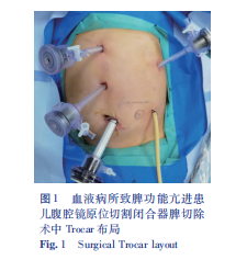 切割闭合器怎么用小儿微创外科技术专题／王建尧 应用直线切割闭合器行腹腔镜原位脾切除术治疗儿童血液病所致脾功能亢进的临床研究_https://www.jmylbn.com_新闻资讯_第4张