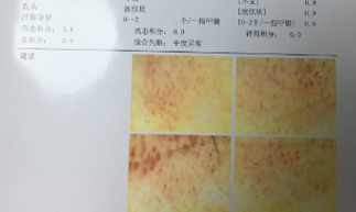 做个系统的白癜风检查需要多少钱？