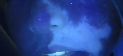 春季，白癜风最常见的这些变化