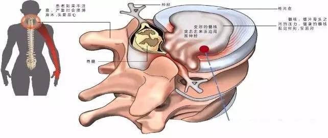 肩颈保养，你必须做的理由