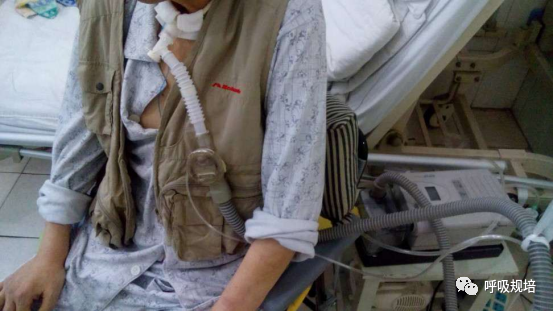 什么是有创呼吸机网红用的呼吸机——被忽视的无创呼吸机做有创通气_https://www.jmylbn.com_新闻资讯_第2张