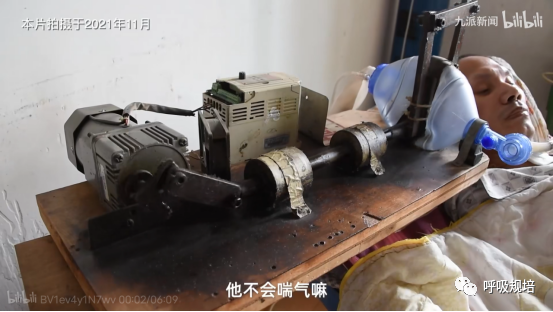 什么是有创呼吸机网红用的呼吸机——被忽视的无创呼吸机做有创通气_https://www.jmylbn.com_新闻资讯_第1张