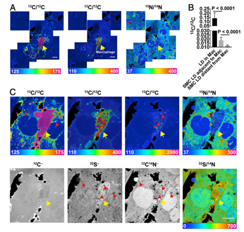 稳定同位素在脂肪酸及脂质代谢中的应用