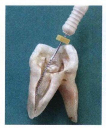 逐步后退法、冠向下法、步进法的一些常见操作解析