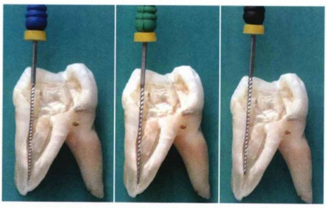 逐步后退法、冠向下法、步进法的一些常见操作解析